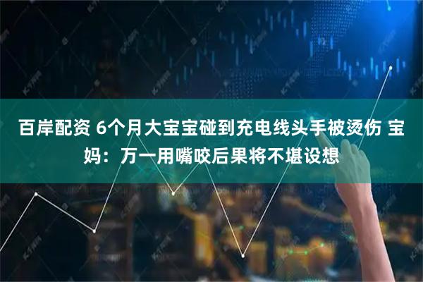 百岸配资 6个月大宝宝碰到充电线头手被烫伤 宝妈：万一用嘴咬后果将不堪设想